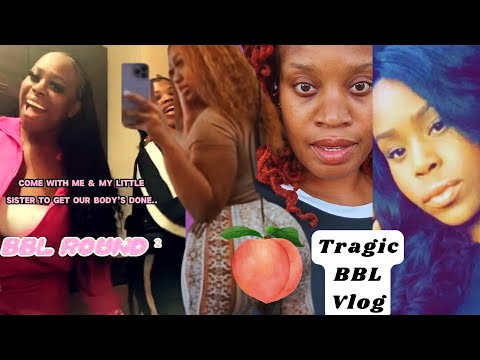 She Filmed Her 2nd BBL Journey…And Then This Happened (Part 1)